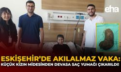 Eskişehir’de Akılalmaz Vaka: Küçük Kızın Midesinden Devasa Saç Yumağı Çıkarıldı!