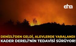 Denizli’den Geldi, Alevlerde Yaralandı: Kader Dereli'nin Tedavisi Sürüyor!