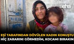 Eşi Tarafından Dövülen Kadın Konuştu: "Hiç Zararını Görmedim, Kocamı Bırakın"
