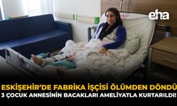 Eskişehir’de Fabrika İşçisi Ölümden Döndü: 3 Çocuk Annesinin Bacakları Ameliyatla Kurtarıldı