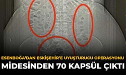 Esenboğa’dan Eskişehir’e Uyuşturucu Operasyonu: Midesinden 70 Kapsül Çıktı