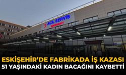 Eskişehir'de Fabikada İş Kazası: 51 Yaşındaki Kadın Bacağını Kaybetti