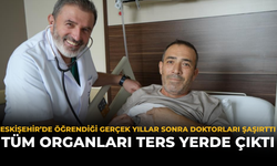 Eskişehir’de Öğrendiği Gerçek Yıllar Sonra Doktorları Şaşırttı: Tüm Organları Ters Yerde Çıktı