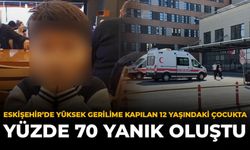 Eskişehir'de Yüksek Gerilime Kapılan 12 Yaşındaki Çocukta Yüzde 70 Yanık Oluştu