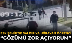 Eskişehir'de Saldırıya Uğrayan Öğrenci: “Gözümü Zor Açıyorum”