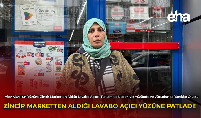 Zincir Marketten Aldığı Lavabo Açıcı Yüzüne Patladı!