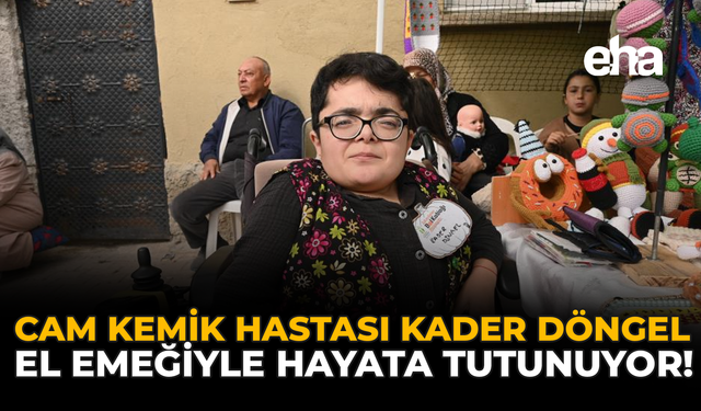 Cam Kemik Hastası Kader Döngel, El Emeğiyle Hayata Tutunuyor!