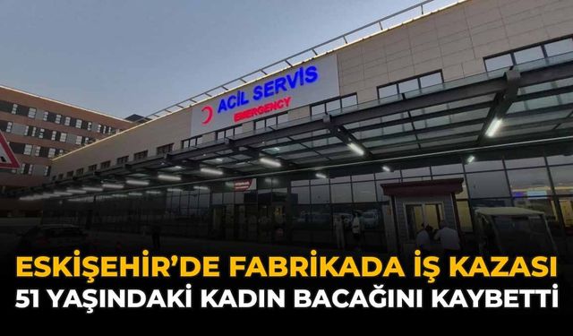 Eskişehir'de Fabikada İş Kazası: 51 Yaşındaki Kadın Bacağını Kaybetti