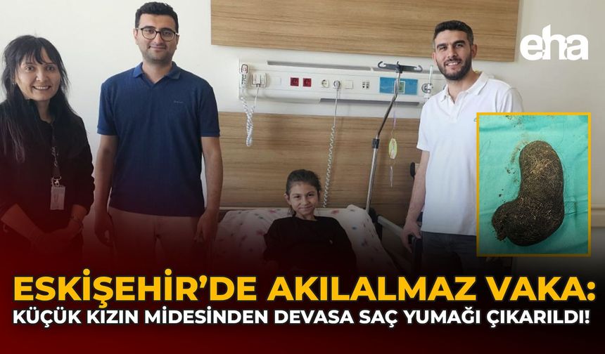 Eskişehir’de Akılalmaz Vaka: Küçük Kızın Midesinden Devasa Saç Yumağı Çıkarıldı!