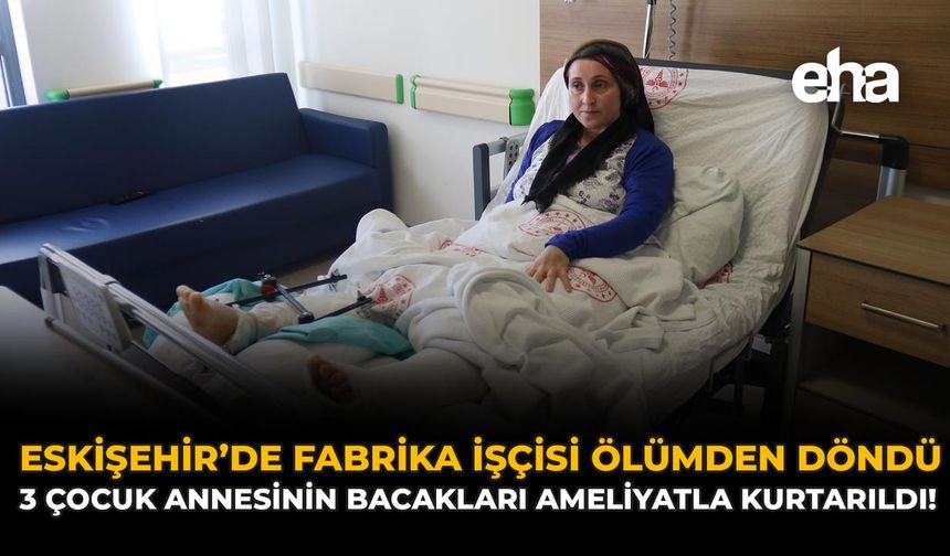 Eskişehir’de Fabrika İşçisi Ölümden Döndü: 3 Çocuk Annesinin Bacakları Ameliyatla Kurtarıldı