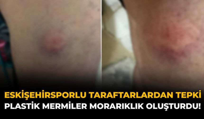 Eskişehirsporlu Taraftarlardan Tepki: "Plastik Mermiler Morarıklık Oluşturdu!"