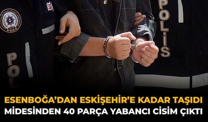 Esenboğa’dan Eskişehir’e Kadar Taşıdı: Midesinden 40 Parça Yabancı Cisim Çıktı