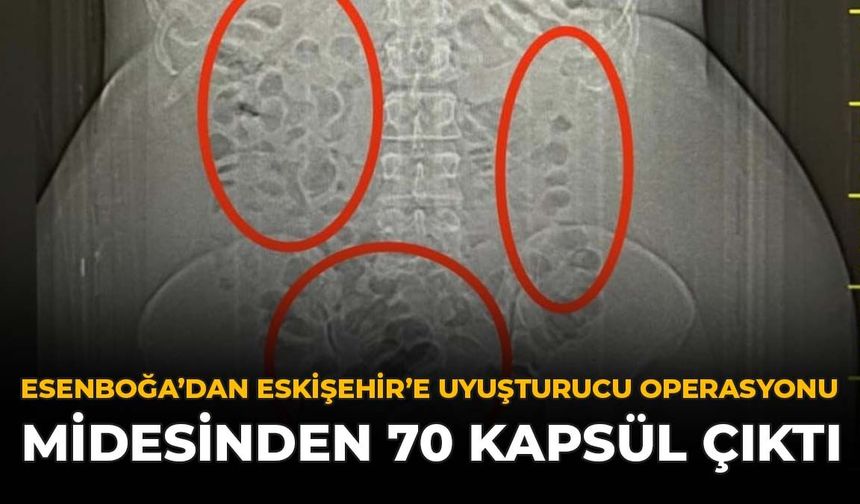 Esenboğa’dan Eskişehir’e Uyuşturucu Operasyonu: Midesinden 70 Kapsül Çıktı
