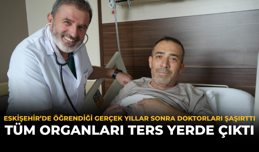 Eskişehir’de Öğrendiği Gerçek Yıllar Sonra Doktorları Şaşırttı: Tüm Organları Ters Yerde Çıktı
