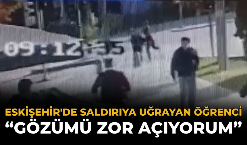 Eskişehir'de Saldırıya Uğrayan Öğrenci: “Gözümü Zor Açıyorum”