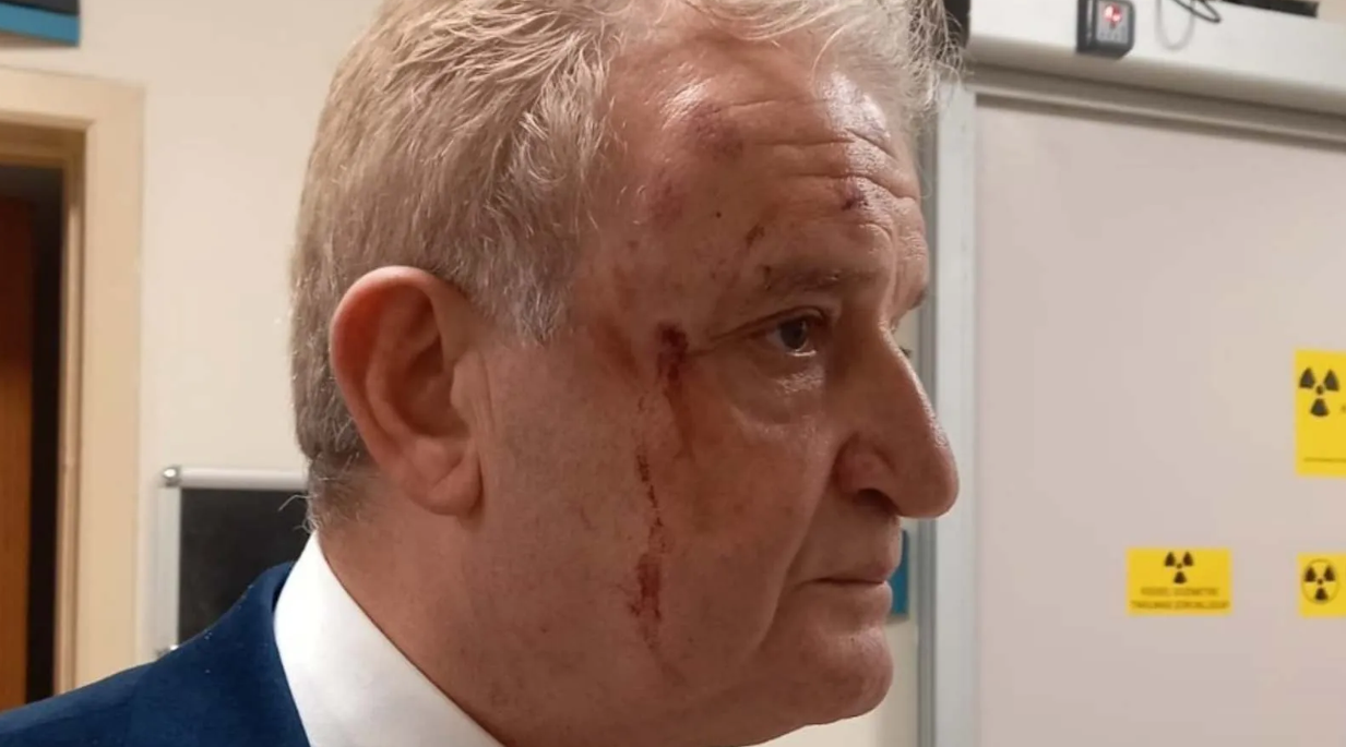 hakkı sağlam saldırı