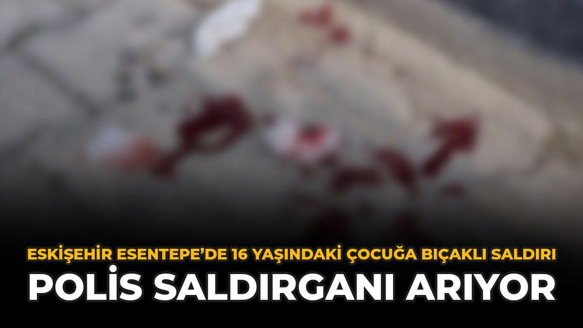 Eskişehir Esentepe'de 16 Yaşındaki Çocuğa Bıçaklı Saldırı: Polis Saldırganı Arıyor