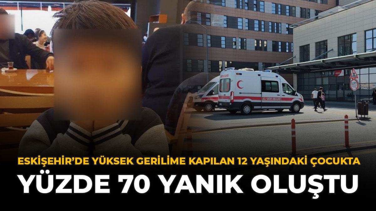 Eskişehir'de Yüksek Gerilime Kapılan 12 Yaşındaki Çocukta Yüzde 70 Yanık Oluştu